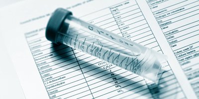 Water Quality & Ionizer Performance